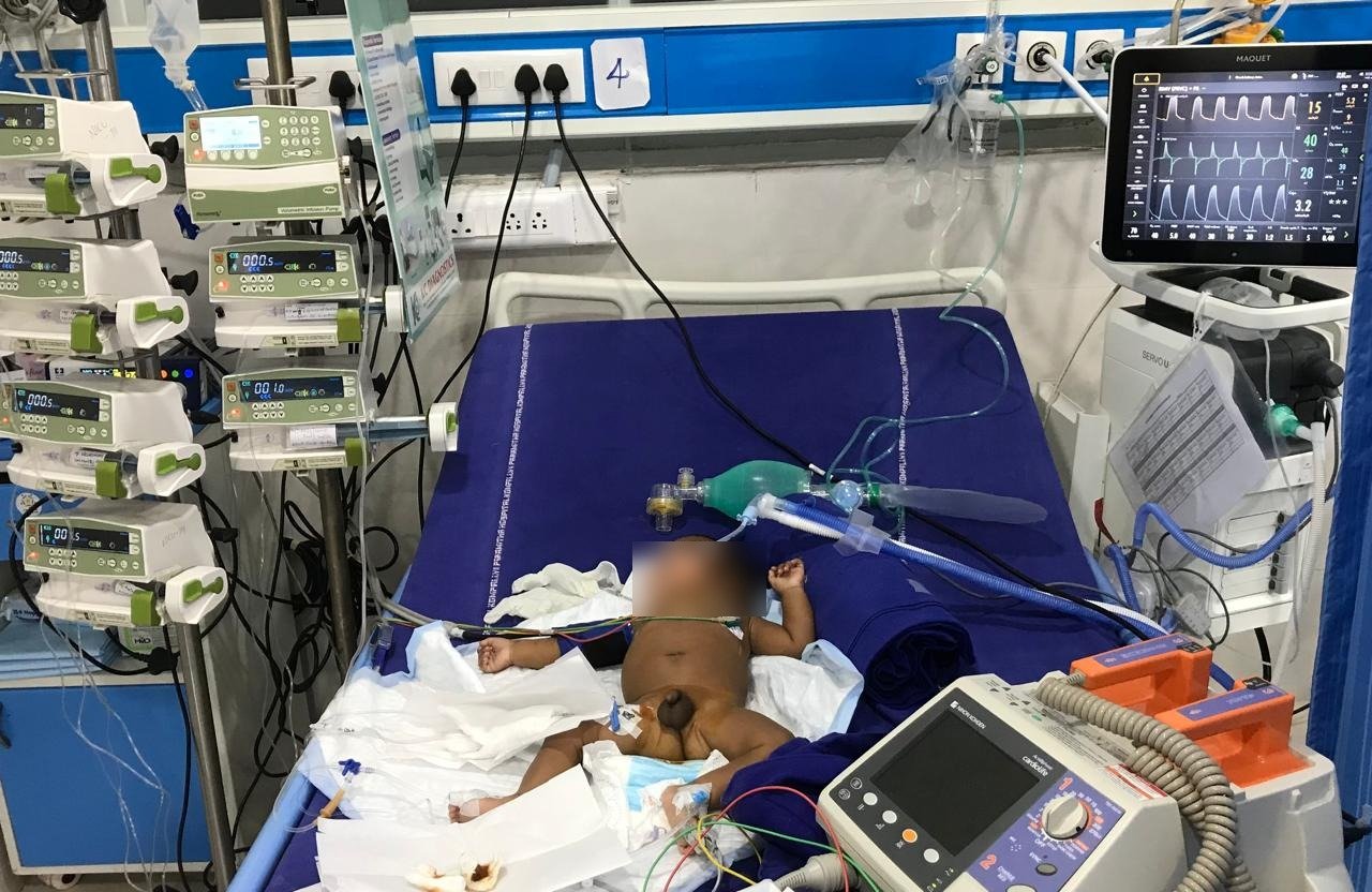 Refractory SVT and Myocarditis patient recovery